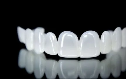 Zirkon Diş Nasıl Takılır?